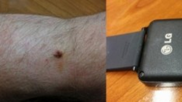 corrosionGate per LG G Watch