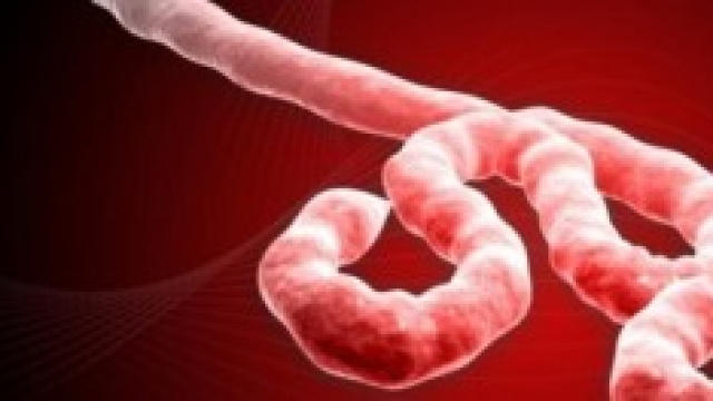 Ebola virus visto al microscopio