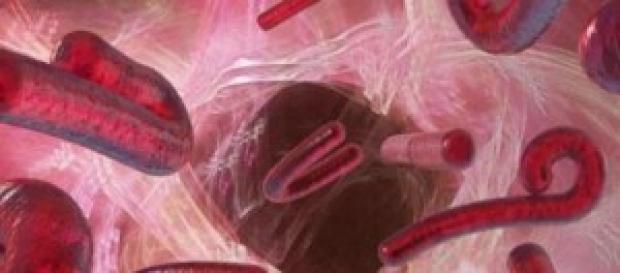 le virus ebola, le début d'une pandémie ? le virus ebola, le début d'une pandémie ?