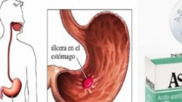 effetti dell'aspirina sul corpo umano