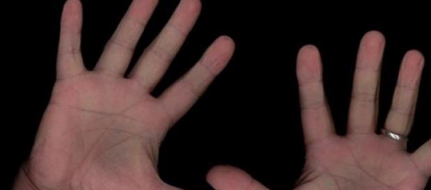 Científicos argentinos pueden frenar el Parkinson Científicos argentinos pueden frenar el Parkinson