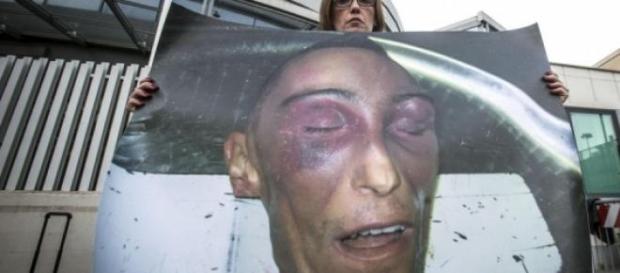 Le immagini di Stefano Cucchi dopo la morte. Le immagini di Stefano Cucchi dopo la morte.