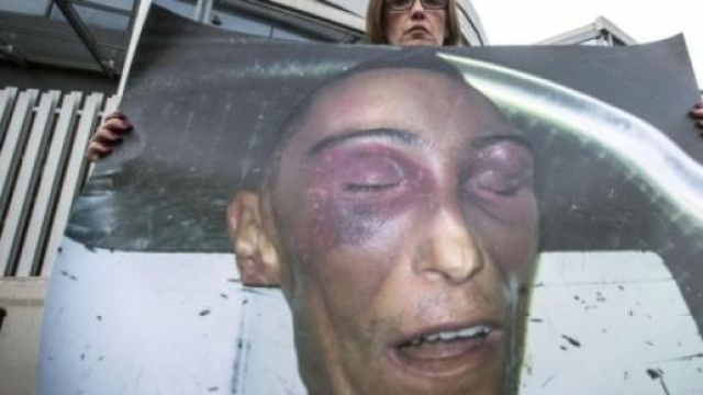 Le immagini di Stefano Cucchi dopo la morte.