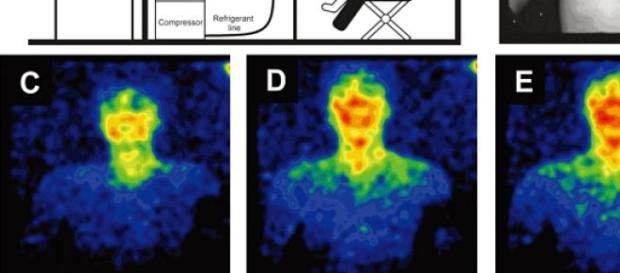 Emisión de biofotones por el cuerpo humano Emisión de biofotones por el cuerpo humano