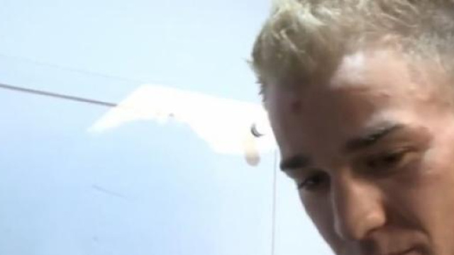 Hart, portiere del Manchester City