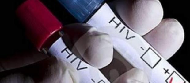 sindrom, flagel, virus, SIDA, HIV sindrom, flagel, virus, SIDA, HIV