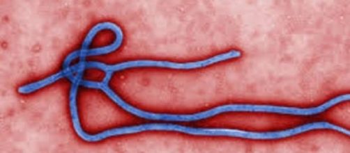 Micrograph of the Ebola Virus