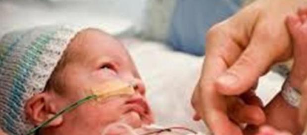 El bebé prematuro necesita excelentes cuidados El bebé prematuro necesita excelentes cuidados