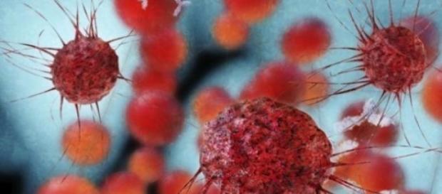 L'immagine al microscopio di una cellula tumorale L'immagine al microscopio di una cellula tumorale