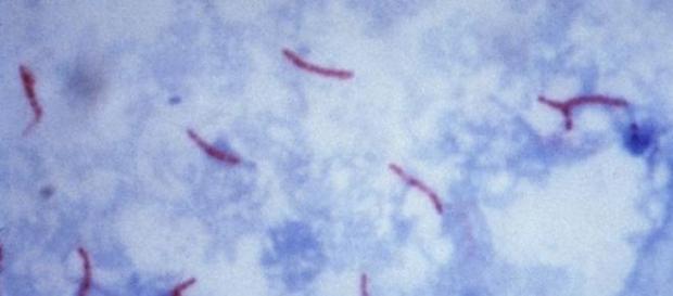 Mycobacterium tuberculosis, enfermedad contagiosa Mycobacterium tuberculosis, enfermedad contagiosa
