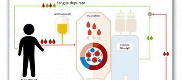 Niño salva su vida gracias a un lavado de sangre Niño salva su vida gracias a un lavado de sangre