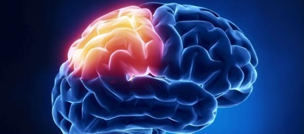 Ictus cerebral, fármaco para reducir los daños Ictus cerebral, fármaco para reducir los daños