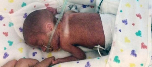 El pequeño Haiden en el hospital de Miami El pequeño Haiden en el hospital de Miami