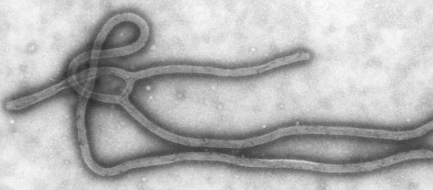 Virus del Ébola al microscopio Virus del Ébola al microscopio