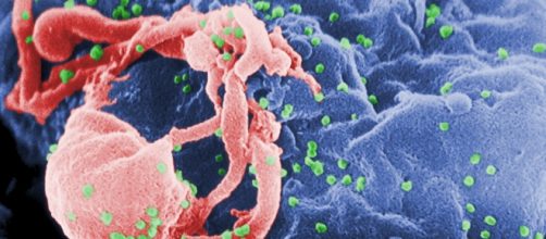 'Foto Wikipedia'. Microscopica immagine dell'HIV