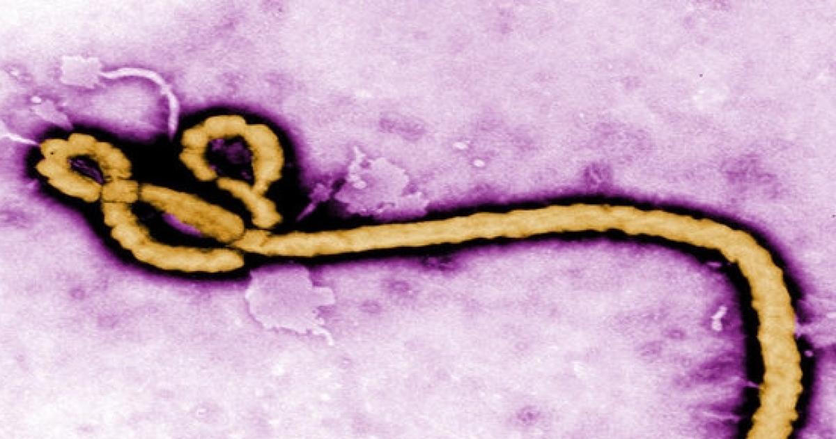 O Vírus Ebola é Sexualmente Transmissível