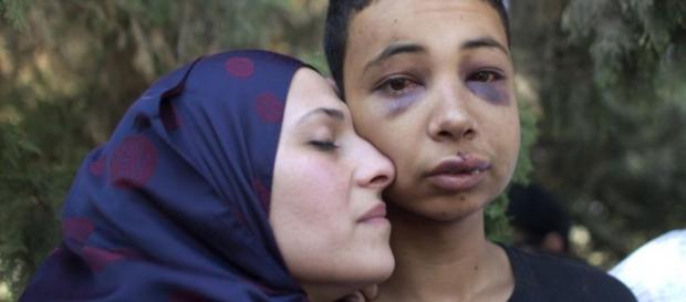 Tariq Abu Khdeir o jovem agredido brutalmente Tariq Abu Khdeir o jovem agredido brutalmente