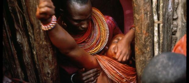 FGM o practică deosebit de dură FGM o practică deosebit de dură