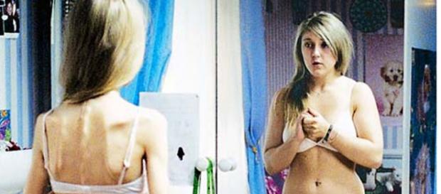 Lo sguardo dell'anoressia: un corpo dismorfico Lo sguardo dell'anoressia: un corpo dismorfico