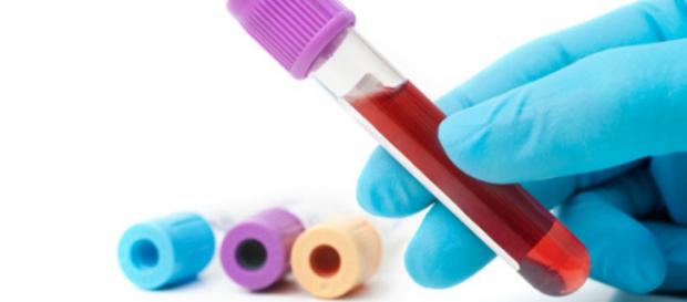 Análisis de sangre para detectar tumores Análisis de sangre para detectar tumores