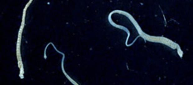 Der Zwergbandwurm unter dem Mikroskop Der Zwergbandwurm unter dem Mikroskop