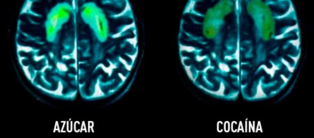 Efectos en el cerebro del azúcar y la cocaína Efectos en el cerebro del azúcar y la cocaína