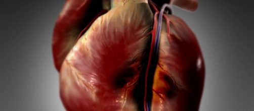 I'infarto nel miocardio in un'immagine in 3D