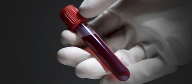 Sângele cu Rh negativ prezintă trăsături speciale Sângele cu Rh negativ prezintă trăsături speciale