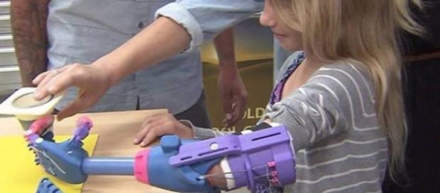 Prótese plástica 3D facilita a vida das crianças Prótese plástica 3D facilita a vida das crianças
