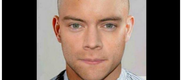 Fãs fizeram montagem de Harry sem cabelo Fãs fizeram montagem de Harry sem cabelo
