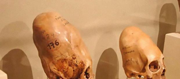 Crânios são mais pesados que os humanos Crânios são mais pesados que os humanos