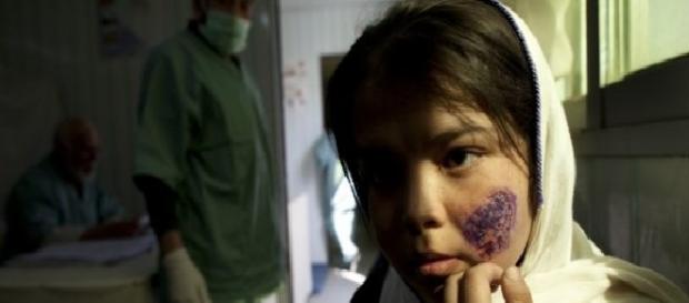 Virusul Leishmanioza a făcut zeci de mii de vizite Virusul Leishmanioza a făcut zeci de mii de vizite