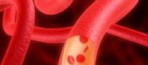 Vasi sanguigni base della circolazione del sangue