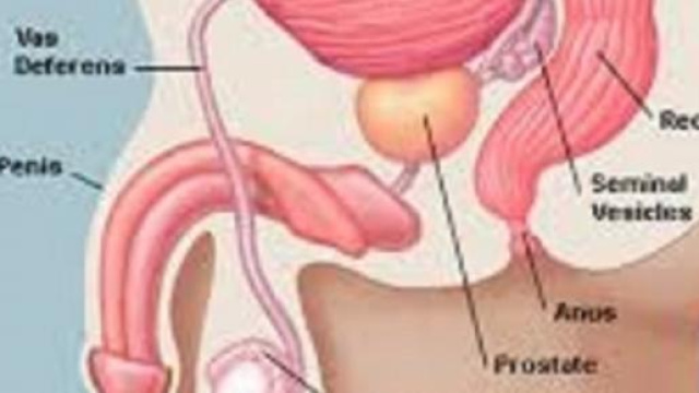 Tumore alla prostata: novità importanti in arrivo 