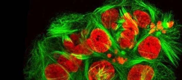 Cellule impazzite causano il cancro Cellule impazzite causano il cancro