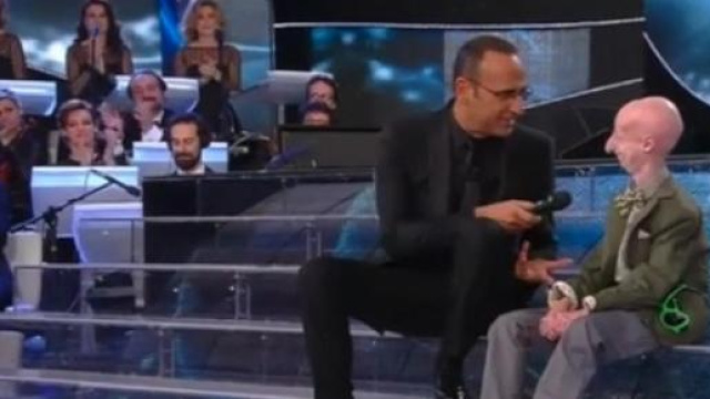 Sammy Basso, il giovane con un corpo da anziano