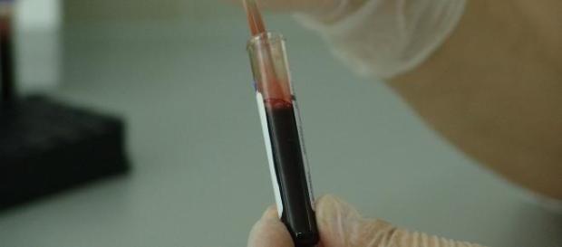 Ébola: novo teste sanguíneo Ébola: novo teste sanguíneo