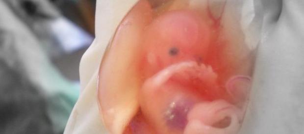 Opinón sobre el derecho a abortar. Opinón sobre el derecho a abortar.