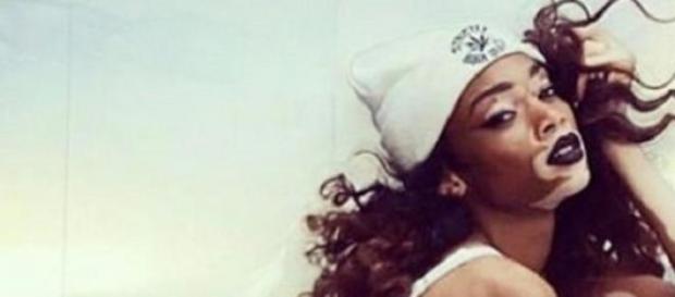 Winnie Harlow la única modelo con vitíligo Winnie Harlow la única modelo con vitíligo