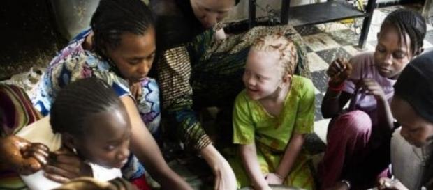 Les organes des albinos ont une valeur de 600$. Les organes des albinos ont une valeur de 600$.