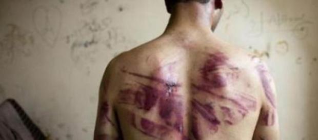 Des images de corps torturés sont exposées à l'ONU Des images de corps torturés sont exposées à l'ONU