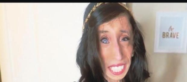 Lizzie a depasit toate problemele Lizzie a depasit toate problemele