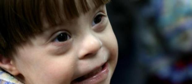 Niño con Síndrome de Down Niño con Síndrome de Down