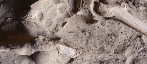 Huesos de 2200 años aC muestran daño por cáncer