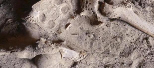 Huesos de 2200 años aC muestran daño por cáncer Huesos de 2200 años aC muestran daño por cáncer