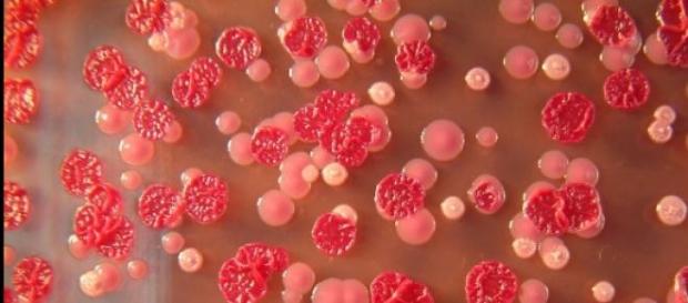 Es una bacteria de gran peligrosidad Es una bacteria de gran peligrosidad