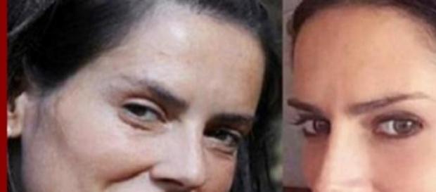 Adriana Barrientos se operó la nariz Adriana Barrientos se operó la nariz