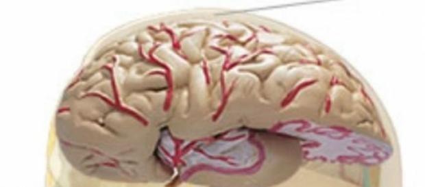 Alzheimer pode vir a ter cura Alzheimer pode vir a ter cura