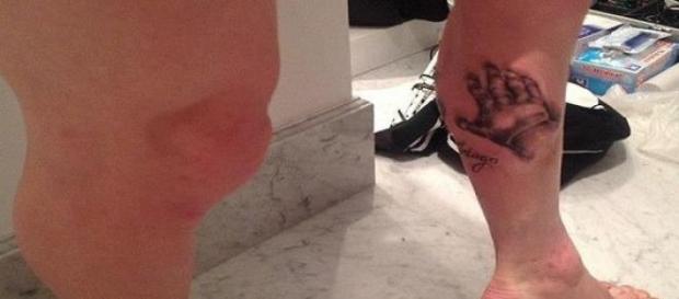 Messi lesionou-se num lance com Demichelis Messi lesionou-se num lance com Demichelis