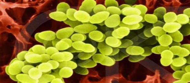 Staphilococcus aureus más agresivo Staphilococcus aureus más agresivo